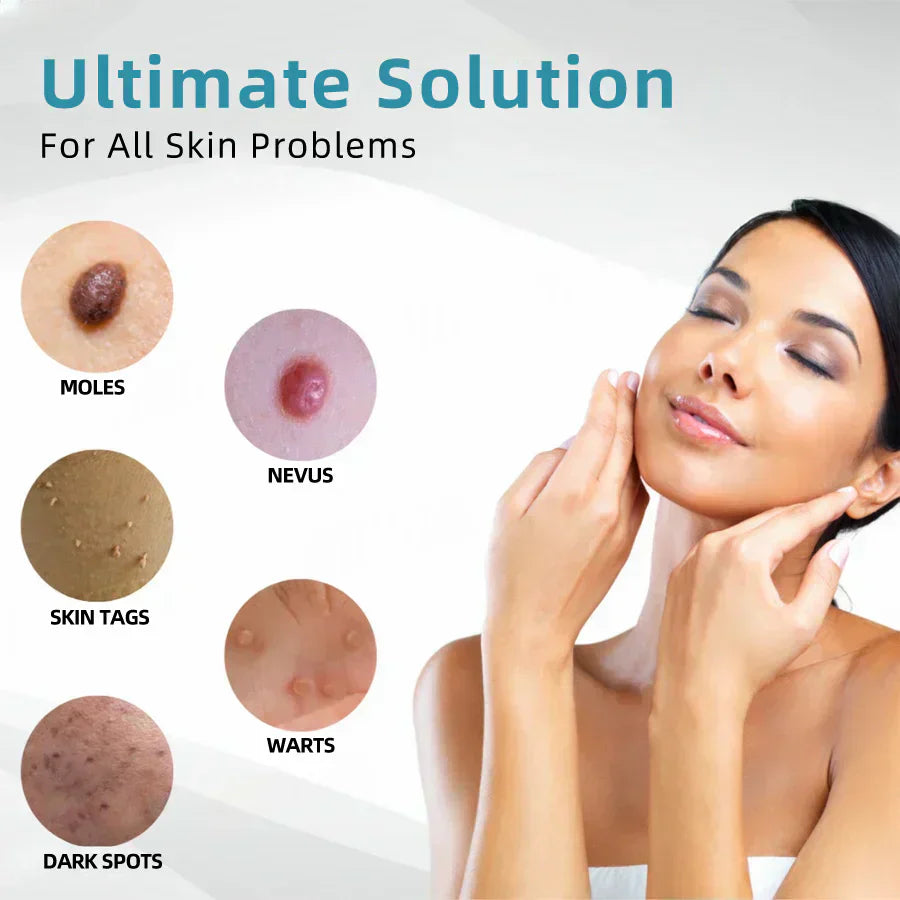 đĽQIAWI⢠All-in-One COâ Laser Eraser Pen | Removes Moles, Warts, Skin Flaws & Pigmentation