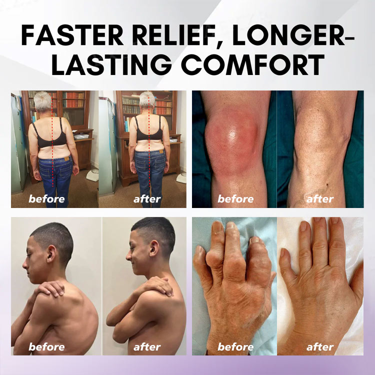 Turmeric & Emu Oil Arthritis Soothing Pain Relief Massage Gel 👨⚕️Australian Osteopathic Association (AOA)Approved