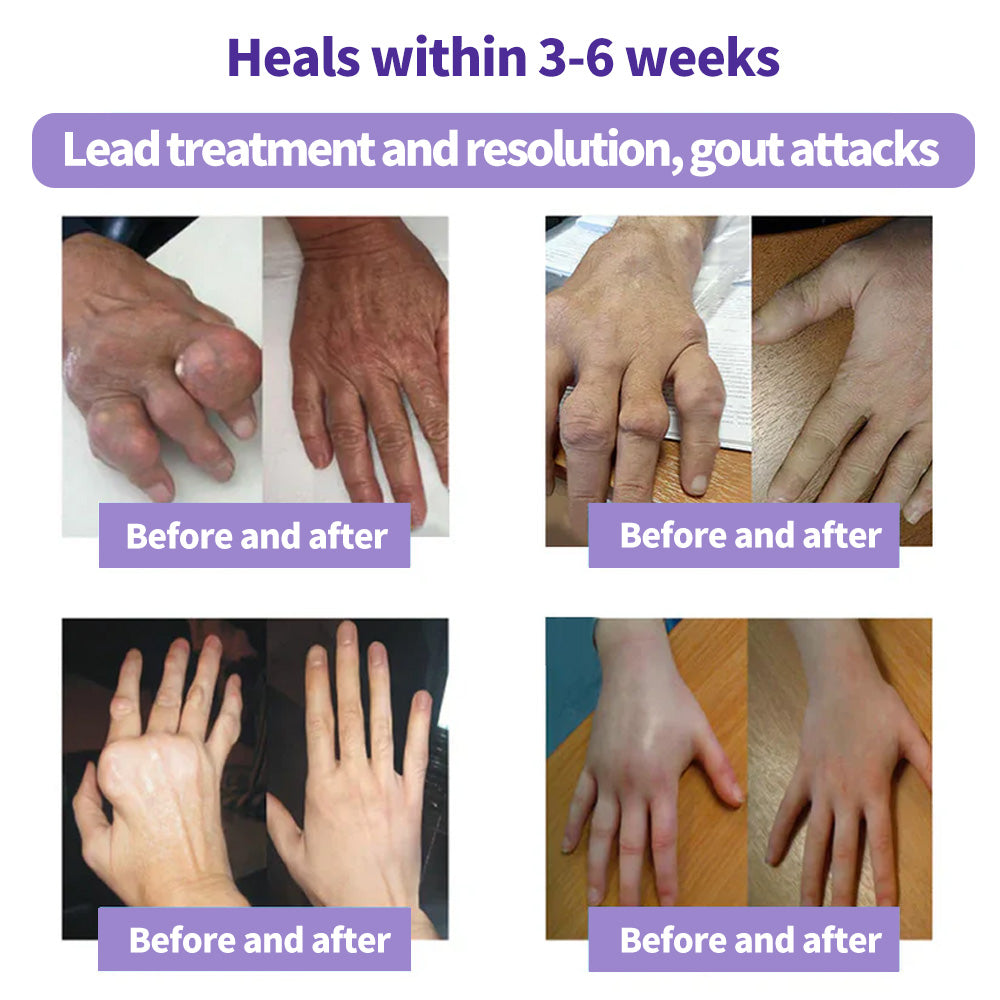 Turmeric & Emu Oil Arthritis Soothing Pain Relief Massage Gel 👨⚕️Australian Osteopathic Association (AOA)Approved