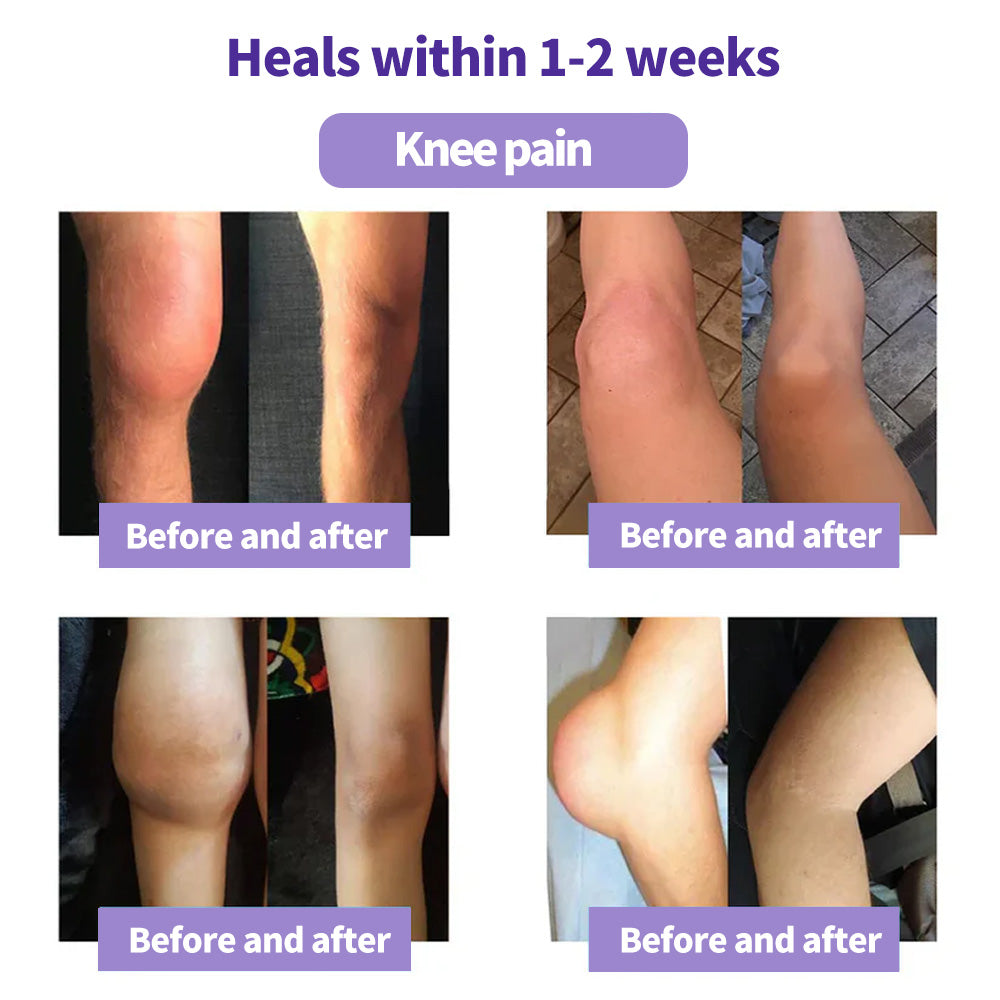 Turmeric & Emu Oil Arthritis Soothing Pain Relief Massage Gel 👨⚕️Australian Osteopathic Association (AOA)Approved