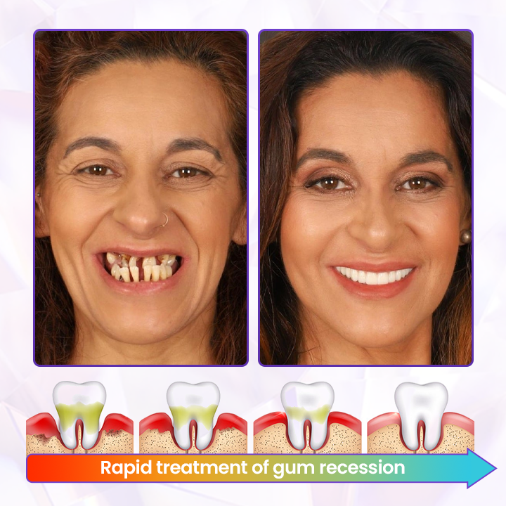 ✨LOVILDS® BeeToxin Advanced Gum Healing Toothpaste✨