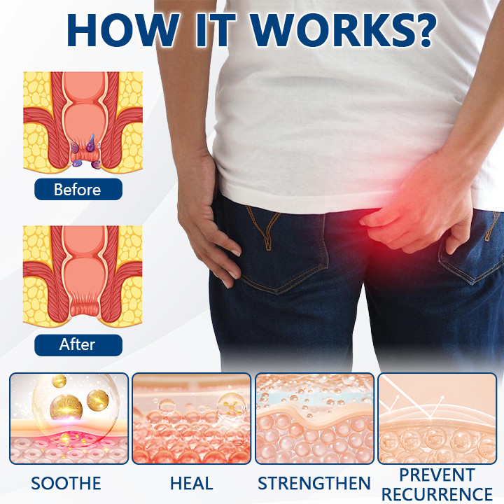 Lovilds® Hemorrhoid Herbal Spray