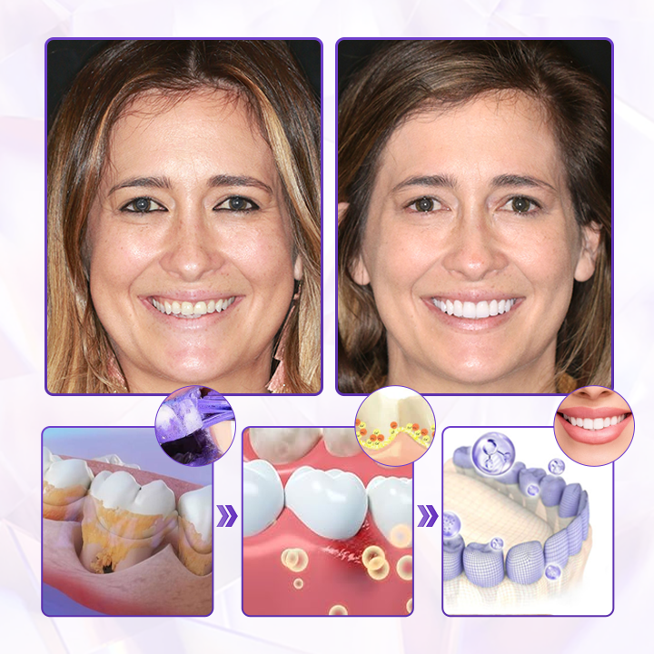 ✨LOVILDS® BeeToxin Advanced Gum Healing Toothpaste✨