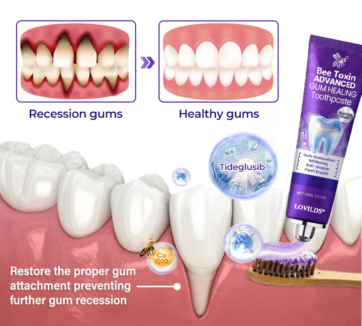 ✨LOVILDS® BeeToxin Advanced Gum Healing Toothpaste✨