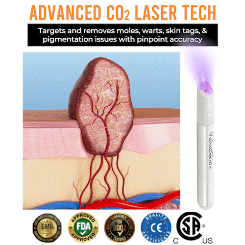 đĽQIAWI⢠All-in-One COâ Laser Eraser Pen | Removes Moles, Warts, Skin Flaws & Pigmentation