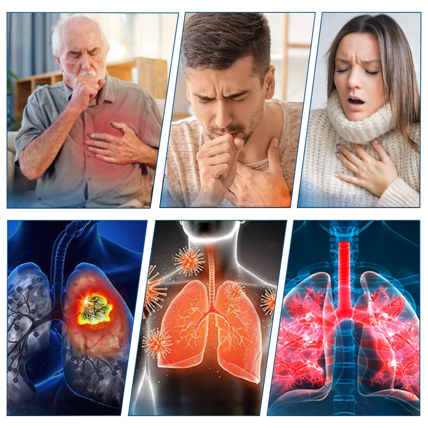 💝FDA Approved LOVILDS™ DoubleNano COPD Relief Patch (💝 Cough, wheezing, shortness of breath, sputum, stuffy nose, bronchitis, bronchitis, allergy symptoms, lung discomfort)