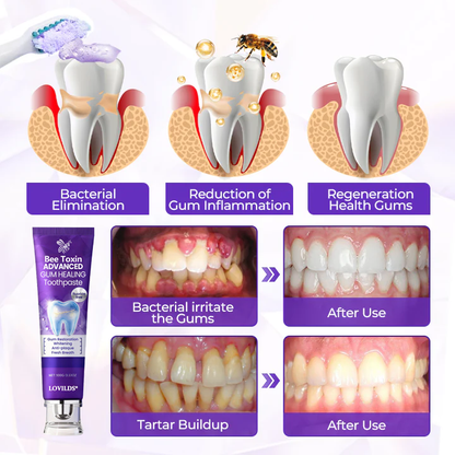 LOVILDS®  BeeToxin Advanced Gum Healing Toothpaste
