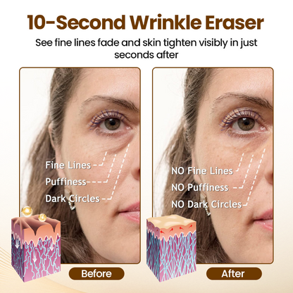✨LOVILDS® Liftora 10s Wrinkle Serum✨