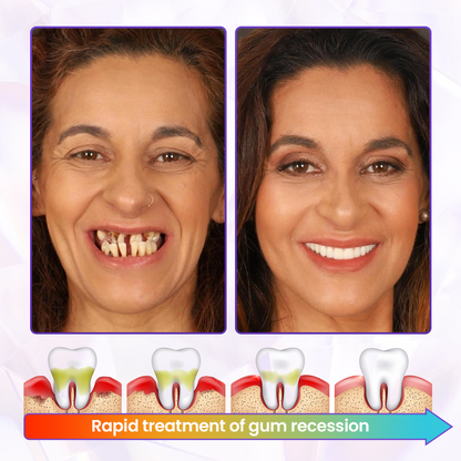 LOVILDS®  BeeToxin Advanced Gum Healing Toothpaste